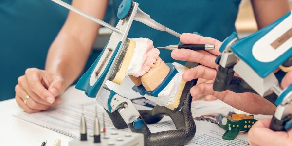prótesis dentales en Barcelona,
