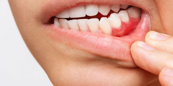 periodoncia periodoncia en barcelona